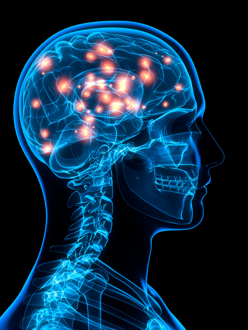 Cullman brain injury<br />
