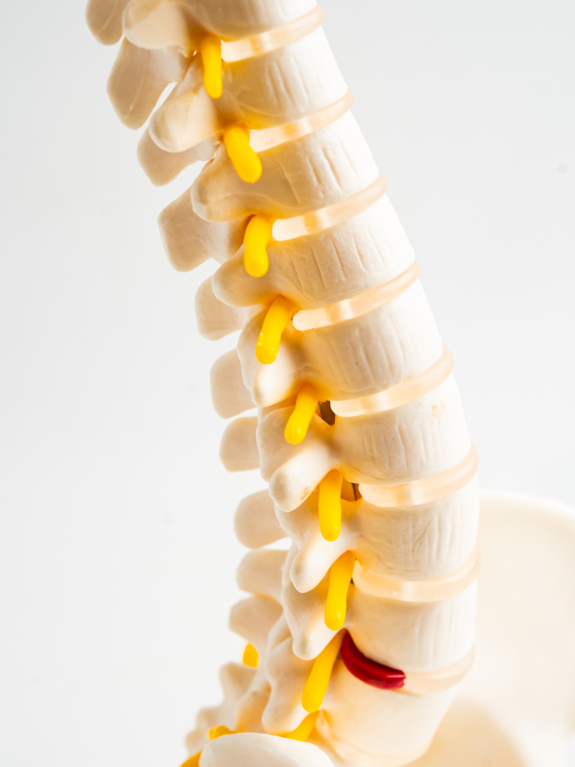 Cullman spinal cord injury