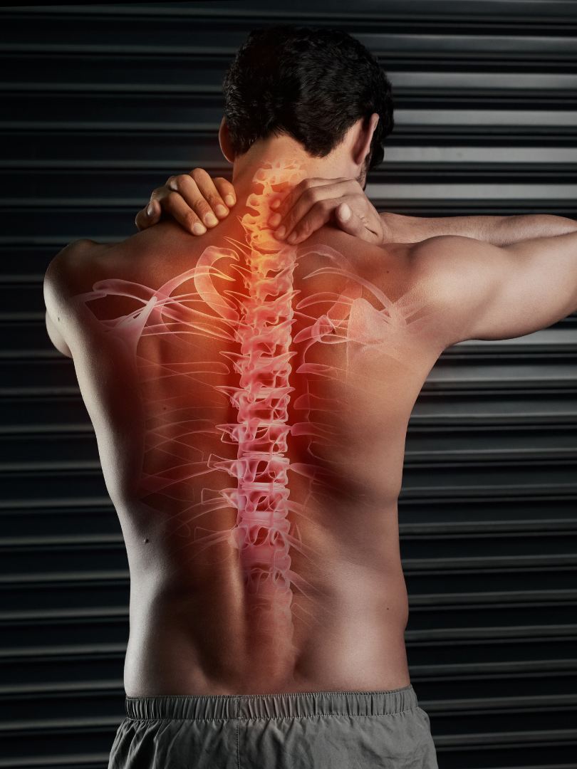 spinal cord injury