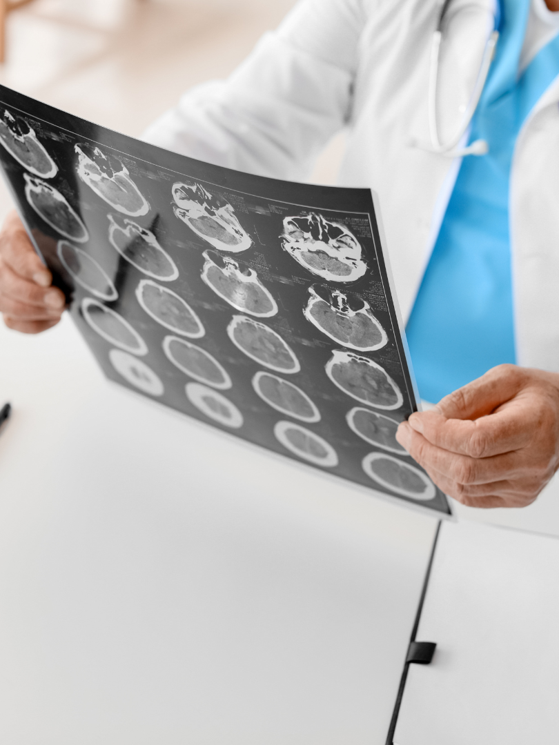brain injury lawyers in Hartselle, Alabama